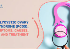 PCOS (Polycystic Ovary Syndrome): Symptoms, and Treatment